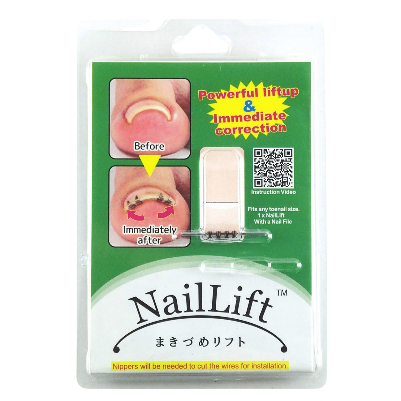 MAKIZUME HOSEI NAILLIFT BEAUTY-INGROWN TOENAIL CORRECTION BRACE KIT